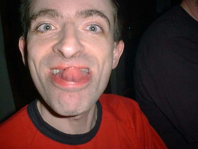 Ah, normality ;)