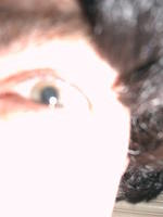 The eye has it!