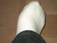 Who says frogs have webbed feet, here's proof that they have fluffy white ones.